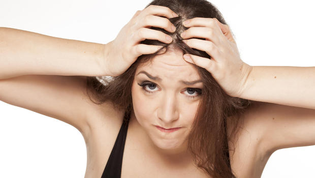 Arthritis drug may help with hair loss condition alopecia