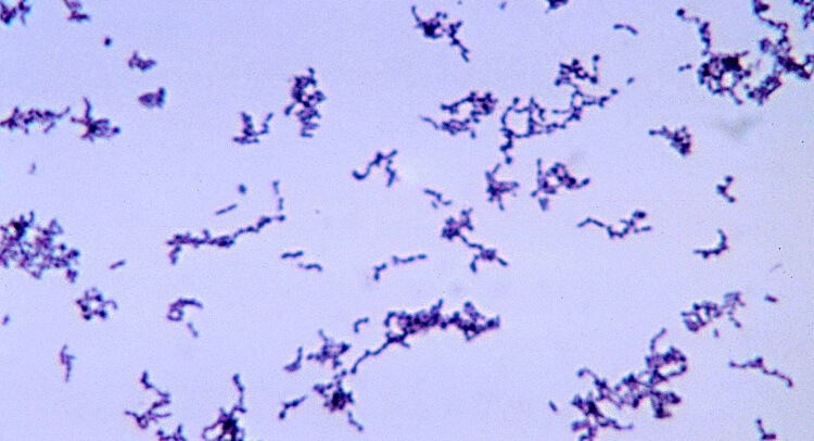 Common Bacteria May Protect Skin from Damage and Disease