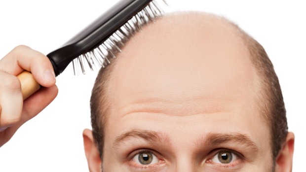 Can hair loss products stop you from going bald?