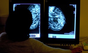 Breast cancer drug approved for NHS use after price cut