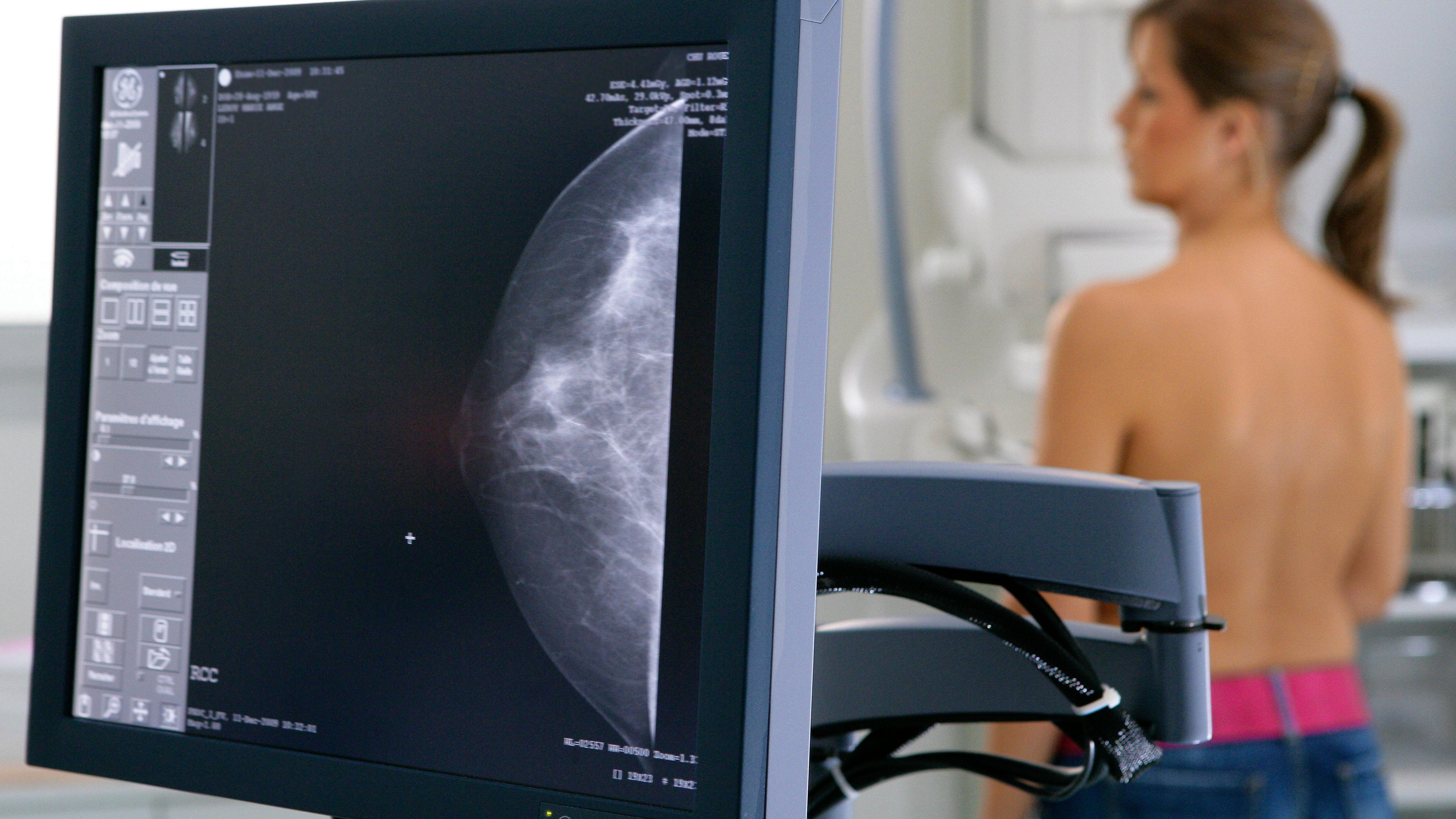 Make 43p breast cancer drug available to all, say doctors