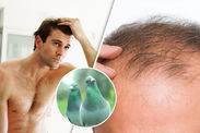 Hair loss cure gives this balding man a full head of hair – would YOU try it?