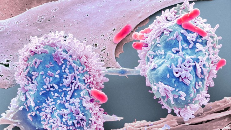 Using data science to beat cancer