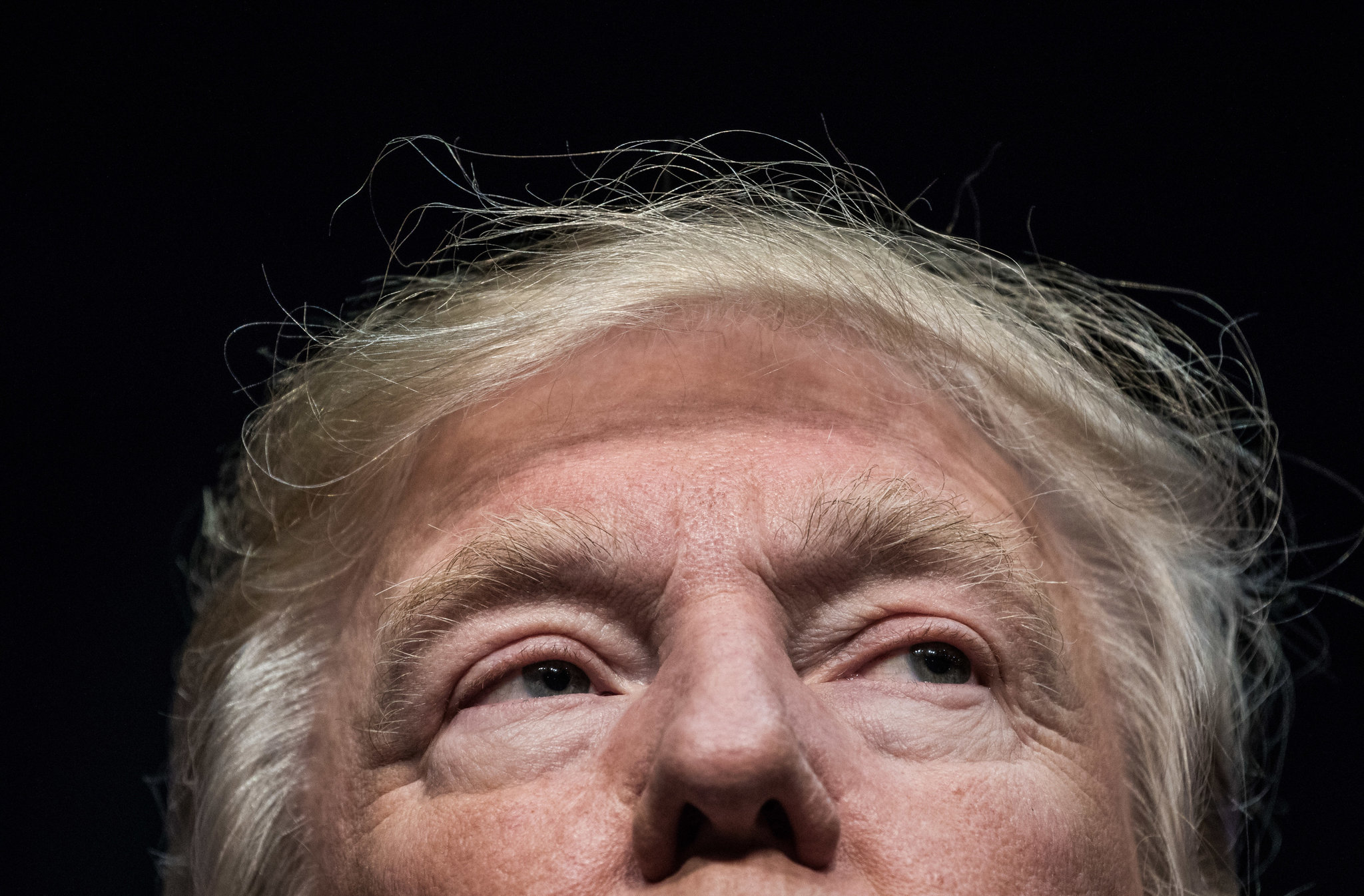 Trump Takes the Hair-Growth Drug Propecia. How Does It Work?