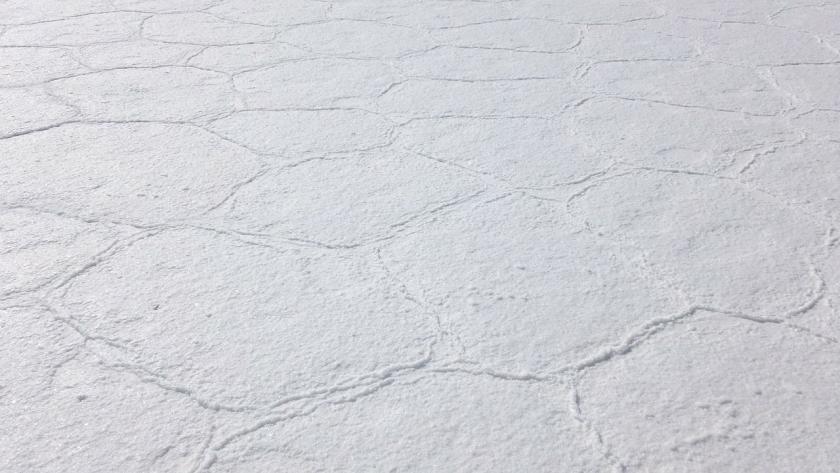 Salty Skin Is A Sign Of Heart Problems For People With Kidney Disease