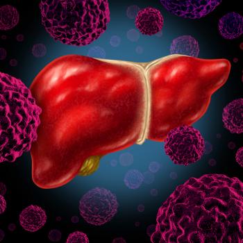 Advanced liver cancer Selective internal radiation therapy safer than sorafenib