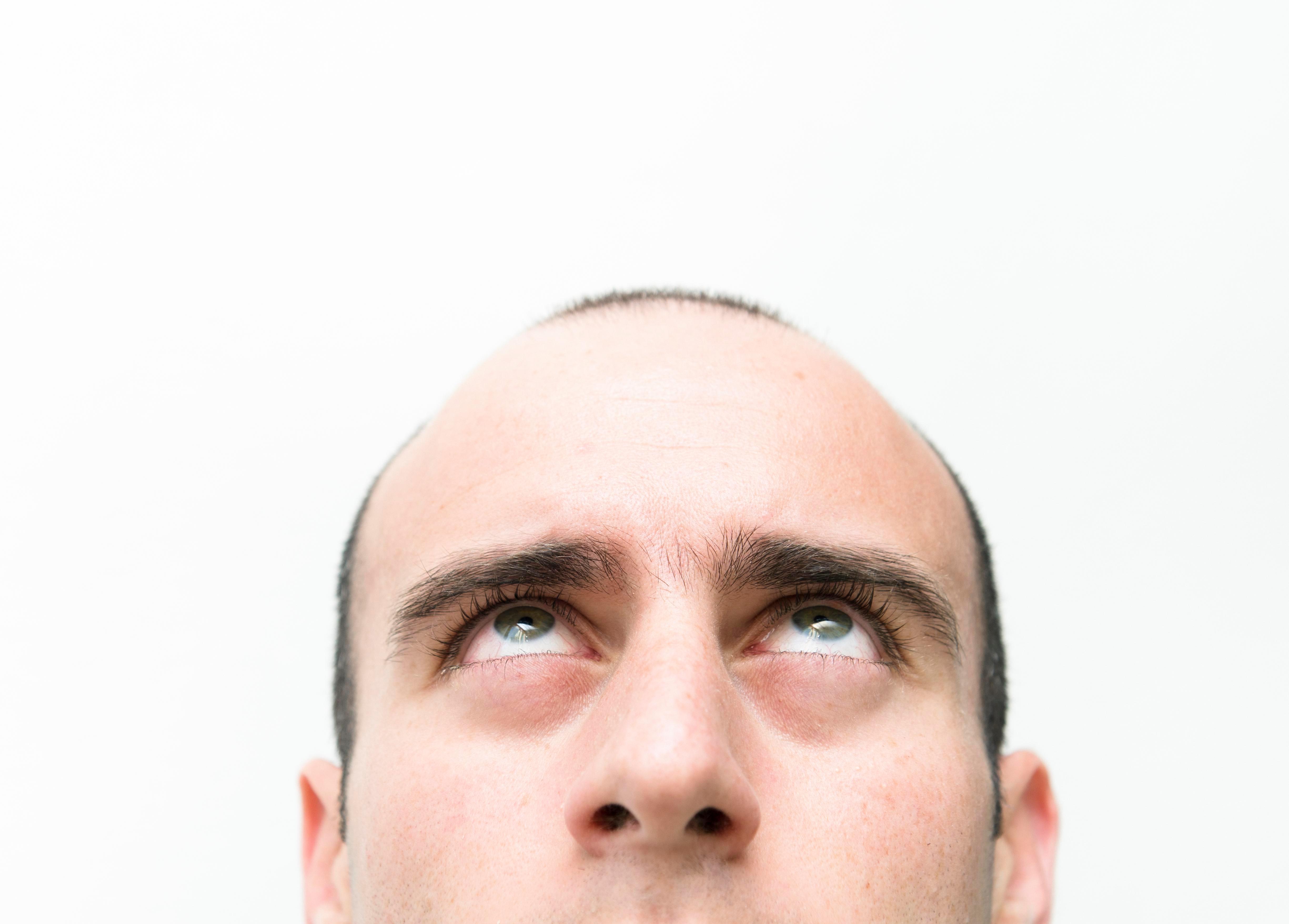 HAIR RAISING Cure for BALDNESS is a step closer after scientists pinpoint the cells that trigger hair growth