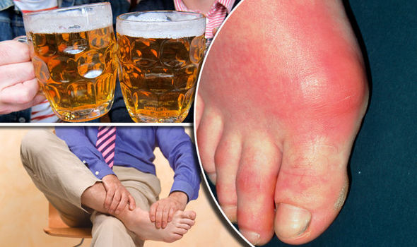 Gout diet – why you should avoid THIS drink to reduce painful symptoms