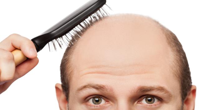 Treating hair loss might be possible with ruxolitinib and tofacitinib drugs