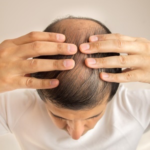5 foods that stop hair loss