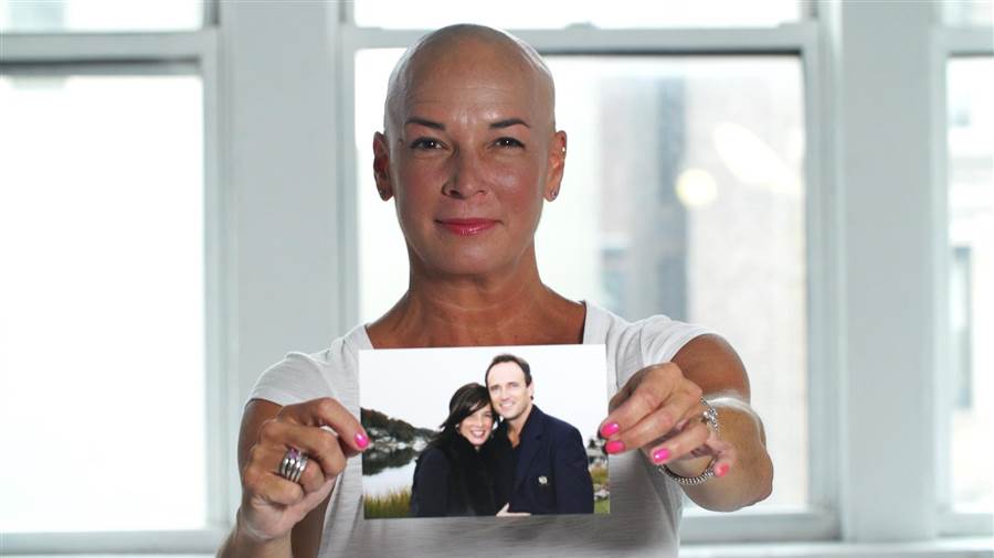 Women open up about hair loss: ‘It’s not spoken about’