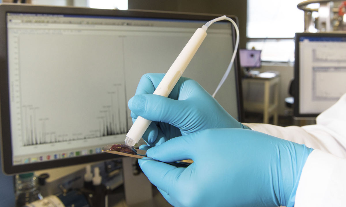 Testing probe to help cancer surgeons know they got it all