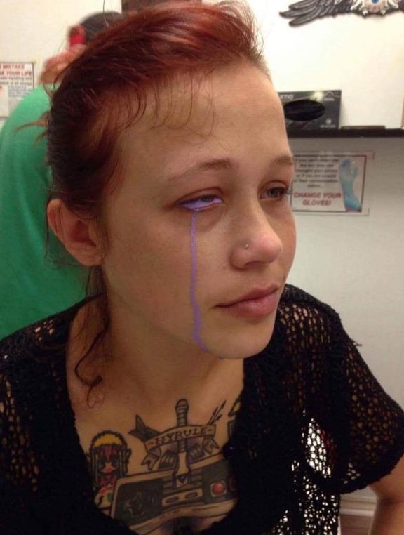 Eyeball tattoo warning: ‘you only get one set of eyes’