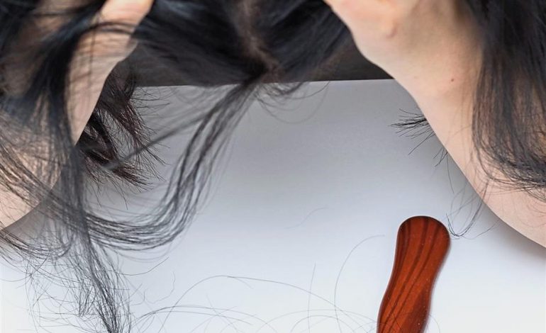 It’s time to talk about women and hair loss