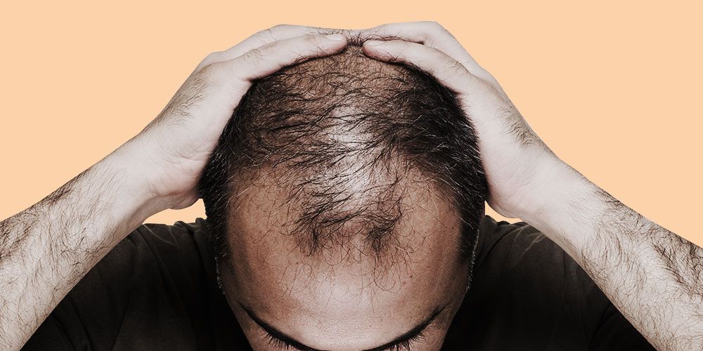 6 Reasons Why You Might Be Losing Your Hair Fast