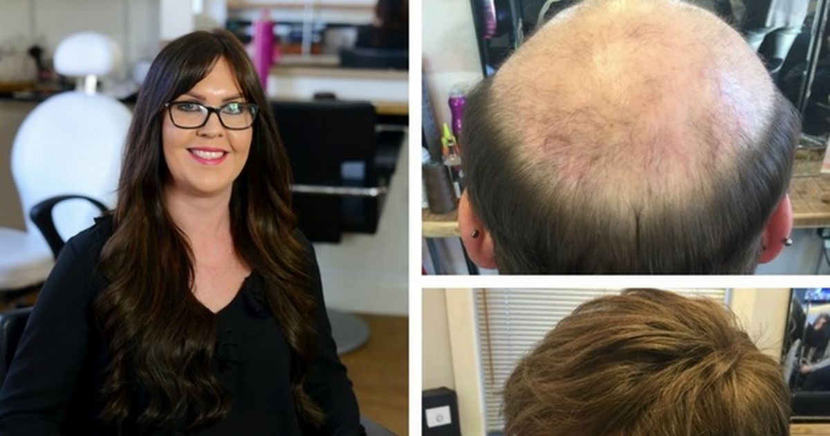 The Plymouth salon leading the way in reversing hair loss