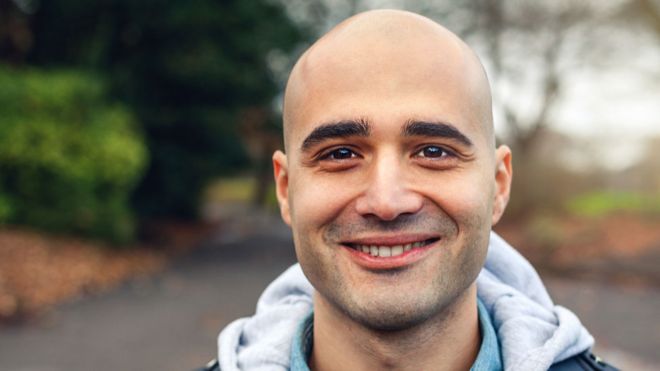 Potential new cure found for baldness