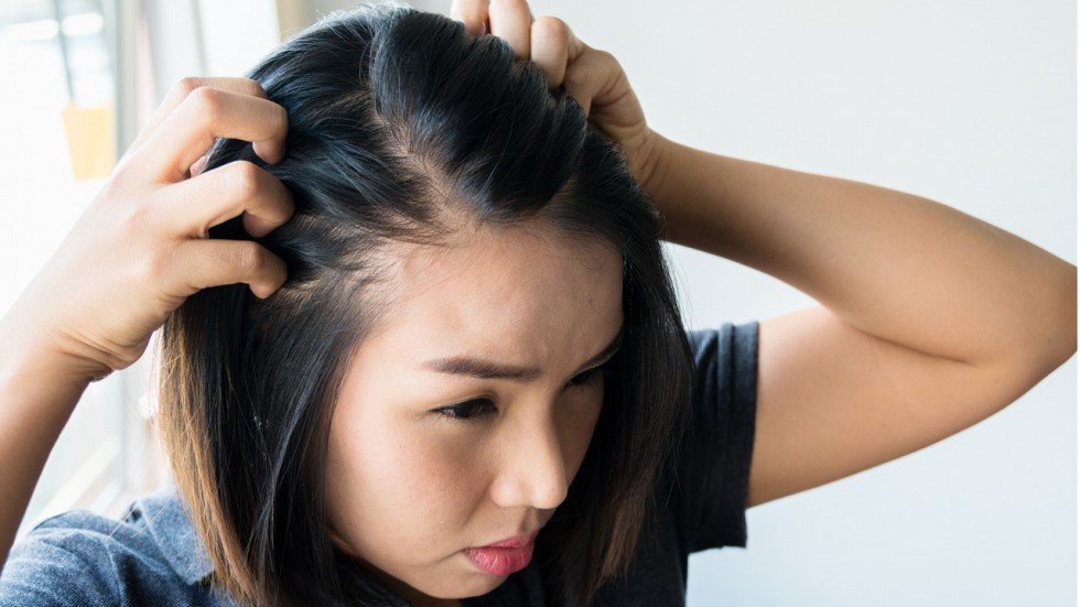5 Beauty Treatments That Combat Hair Loss
