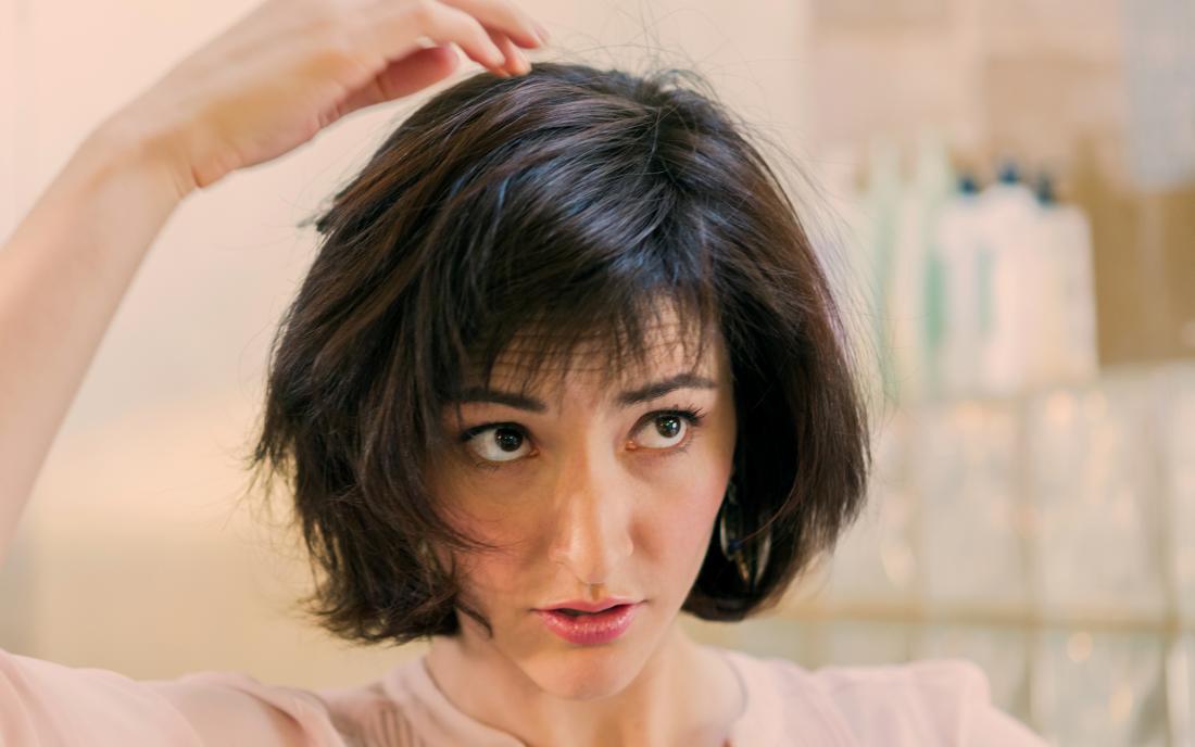 Can seborrheic dermatitis cause hair loss?