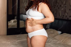no stretch marks during pregnancy
