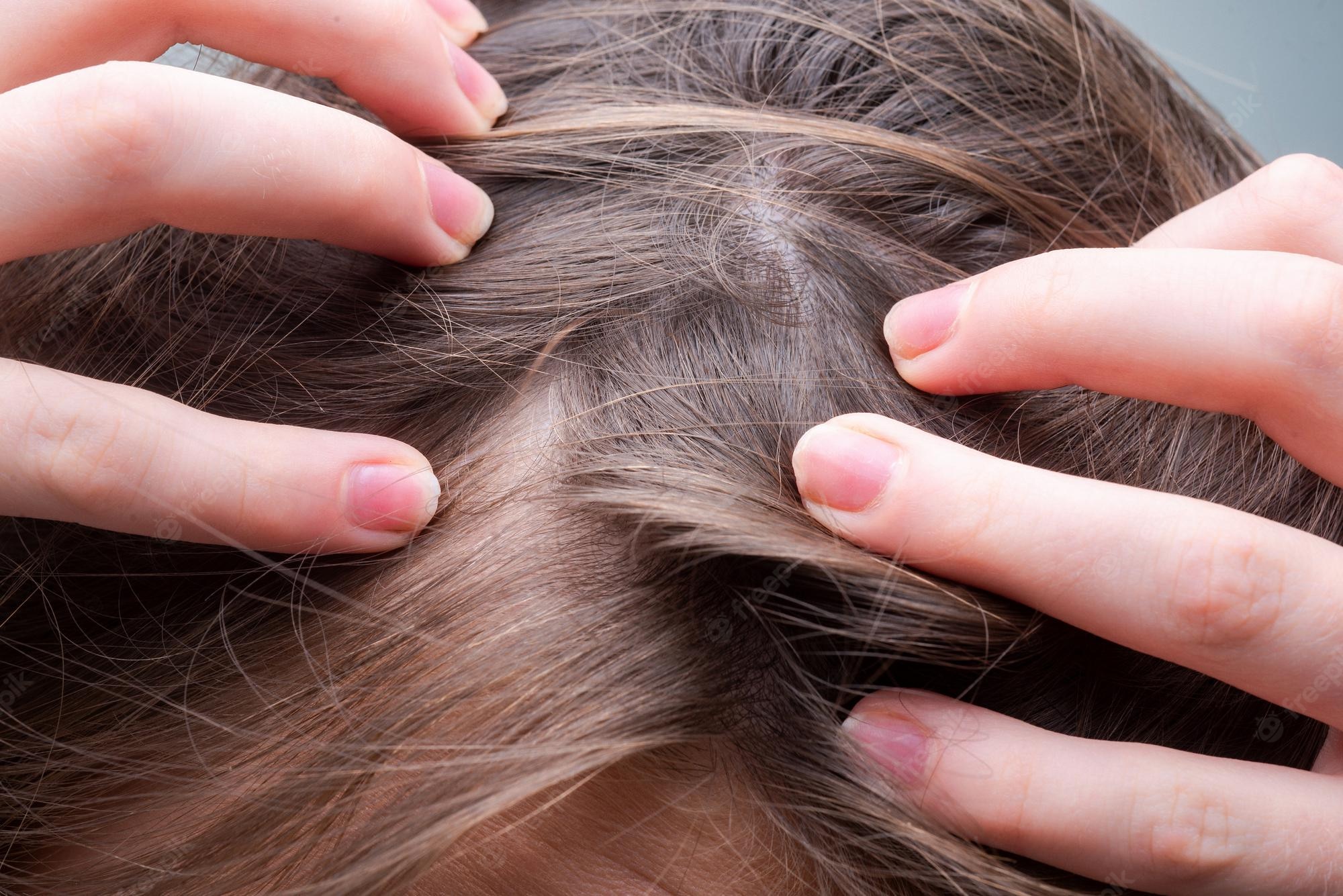 Lotion for stretch marks