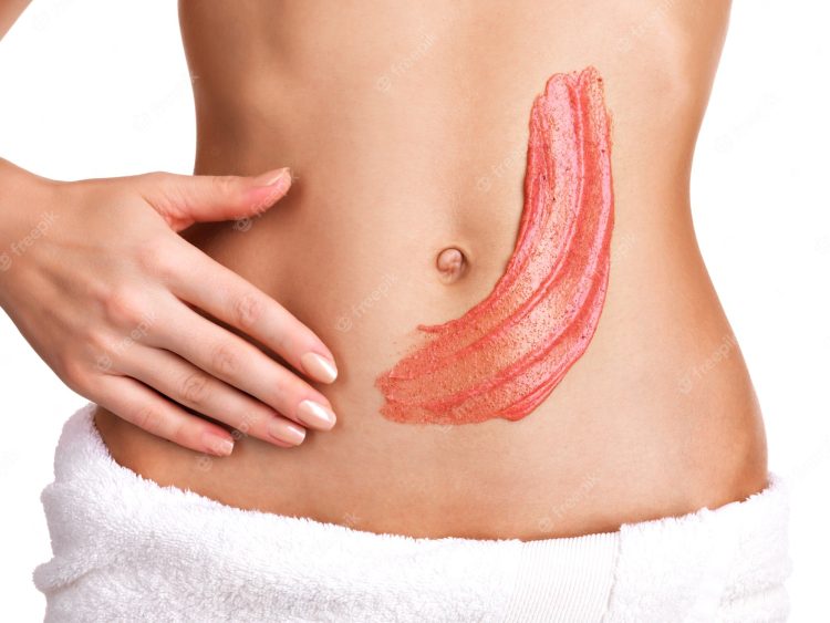 Effective Stretch Mark Removal with Laser Technology