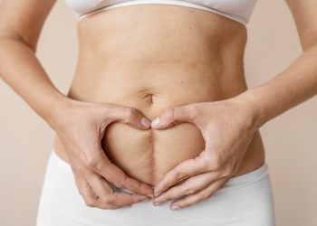Unraveling the Potential: Can Collagen Help Diminish Stretch Marks