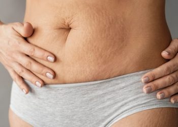 Can Spray Tan Conceal Stretch Marks? Unveiling the Truth and Tips for Flawless Coverage