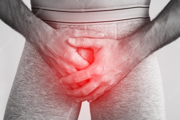 Understanding Penile Stretch Marks: Causes, Treatment, and Prevention