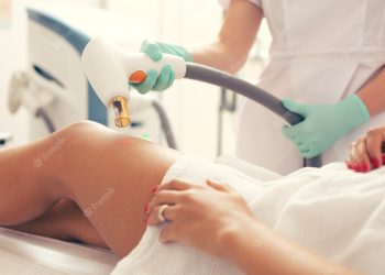Exploring the Cost of Laser Treatment for Stretch Marks: A Comprehensive Analysis