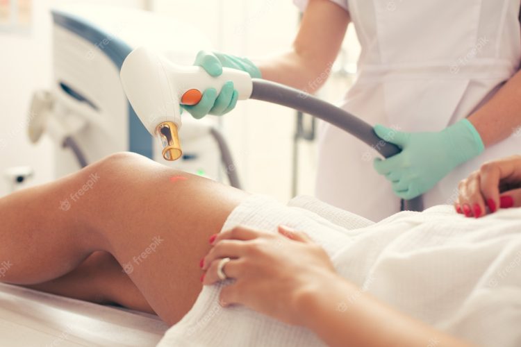 Exploring the Cost of Laser Treatment for Stretch Marks: A Comprehensive Analysis