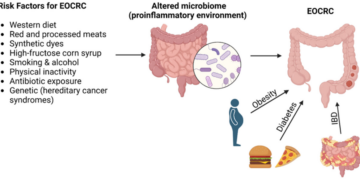 Research Features: Looking Profound into Hereditary Changes that Increment Colorectal Disease Hazard to Forestall or Distinguish Acquired Malignant growths