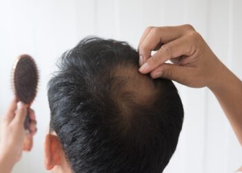 Rosemary Rejuvenating oil versus Minoxidil: The Fight Against Going bald