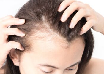 Women’s hair loss: what causes it and how to treat it
