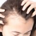 Women’s hair loss: what causes it and how to treat it