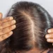 THE BALDNESS STARTING STAGE: HOW TO DETECT HAIR LOSS EARLY